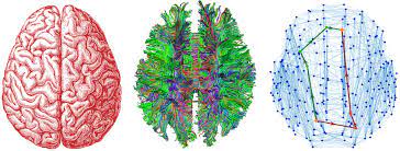 سه تصویر رنگارنگ از مغز انسان در مراحل مختلف انتزاع